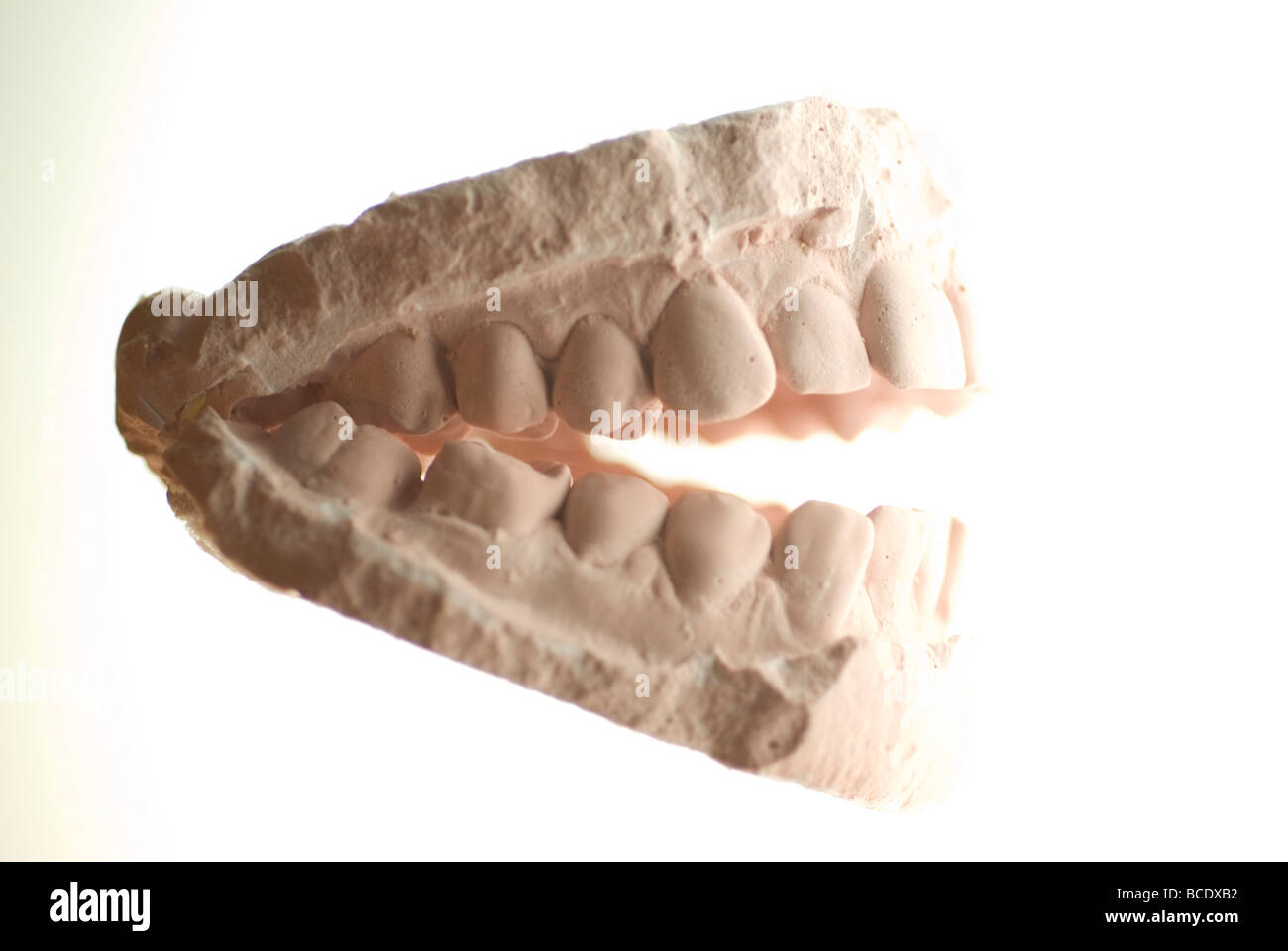 dental cast plaster model Stock Photo