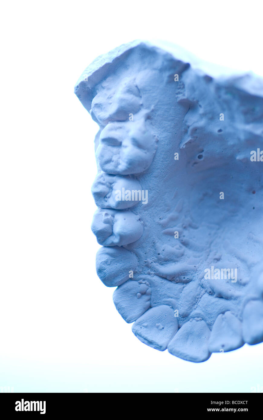 dental cast plaster model on white background Stock Photo Alamy