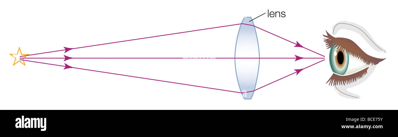 A converging lens focuses the rays from a distant object by causing them to converge at a focal point behind the lens. Stock Photo