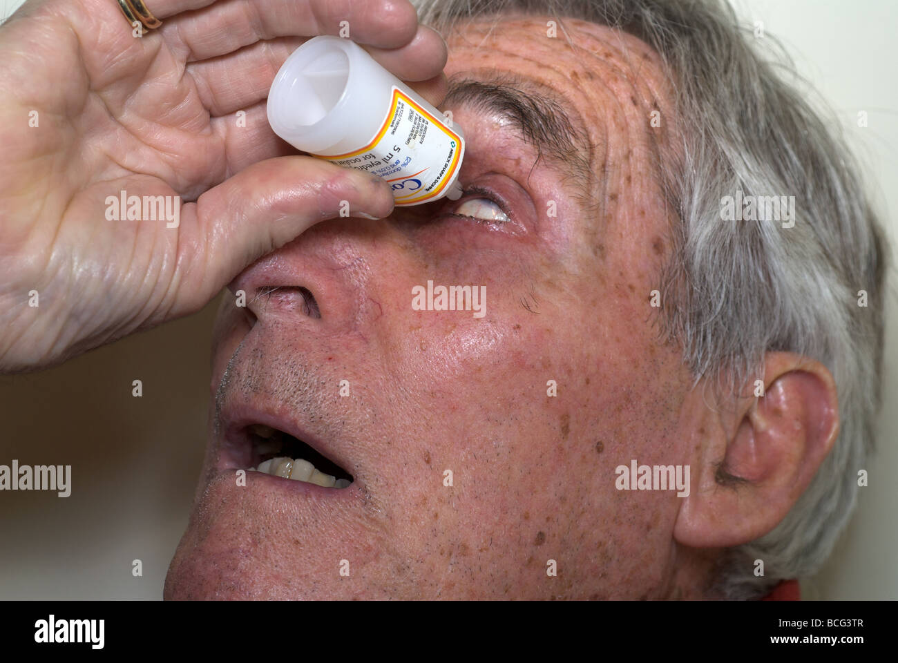 Applying eye drops to treat cataracts Stock Photo