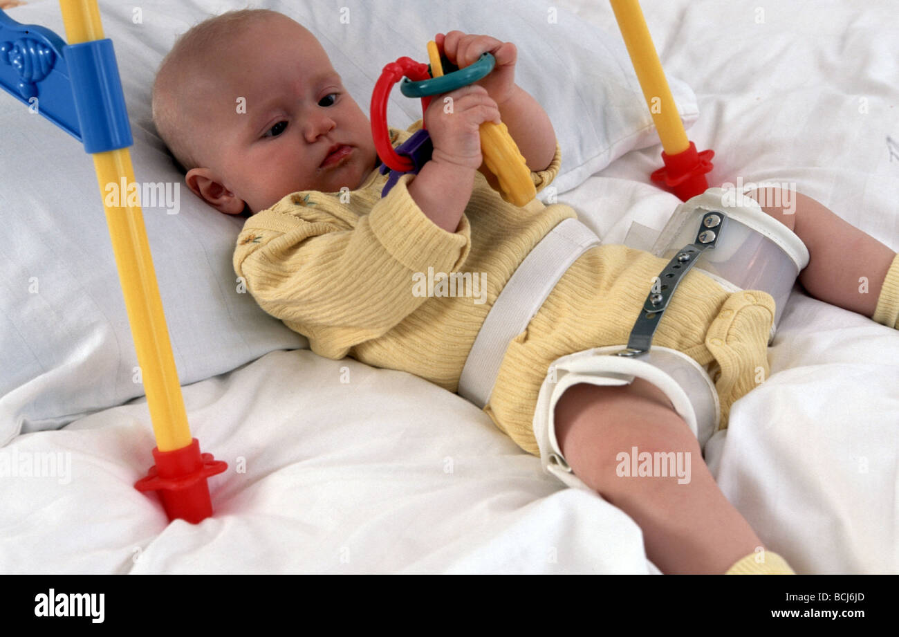 Hip Dysplasia High Resolution Stock Photography and Images