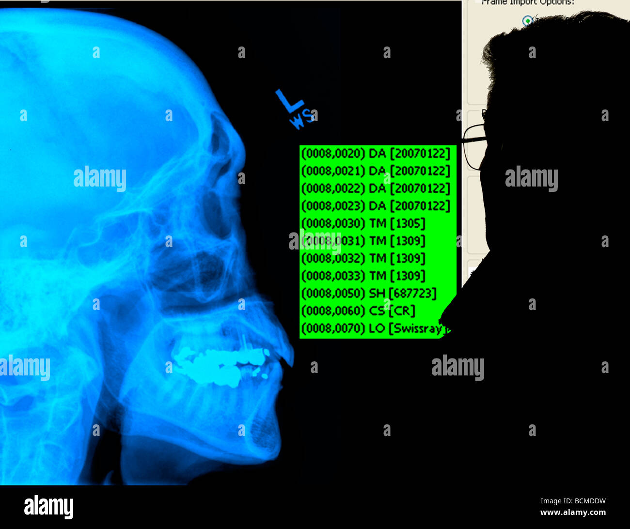 X-ray technician studying human skull chart projection Stock Photo