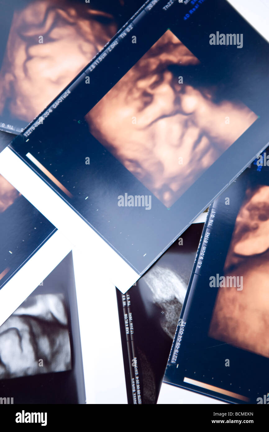 Ultrasound of a fetus embryo boy Stock Photo - Alamy