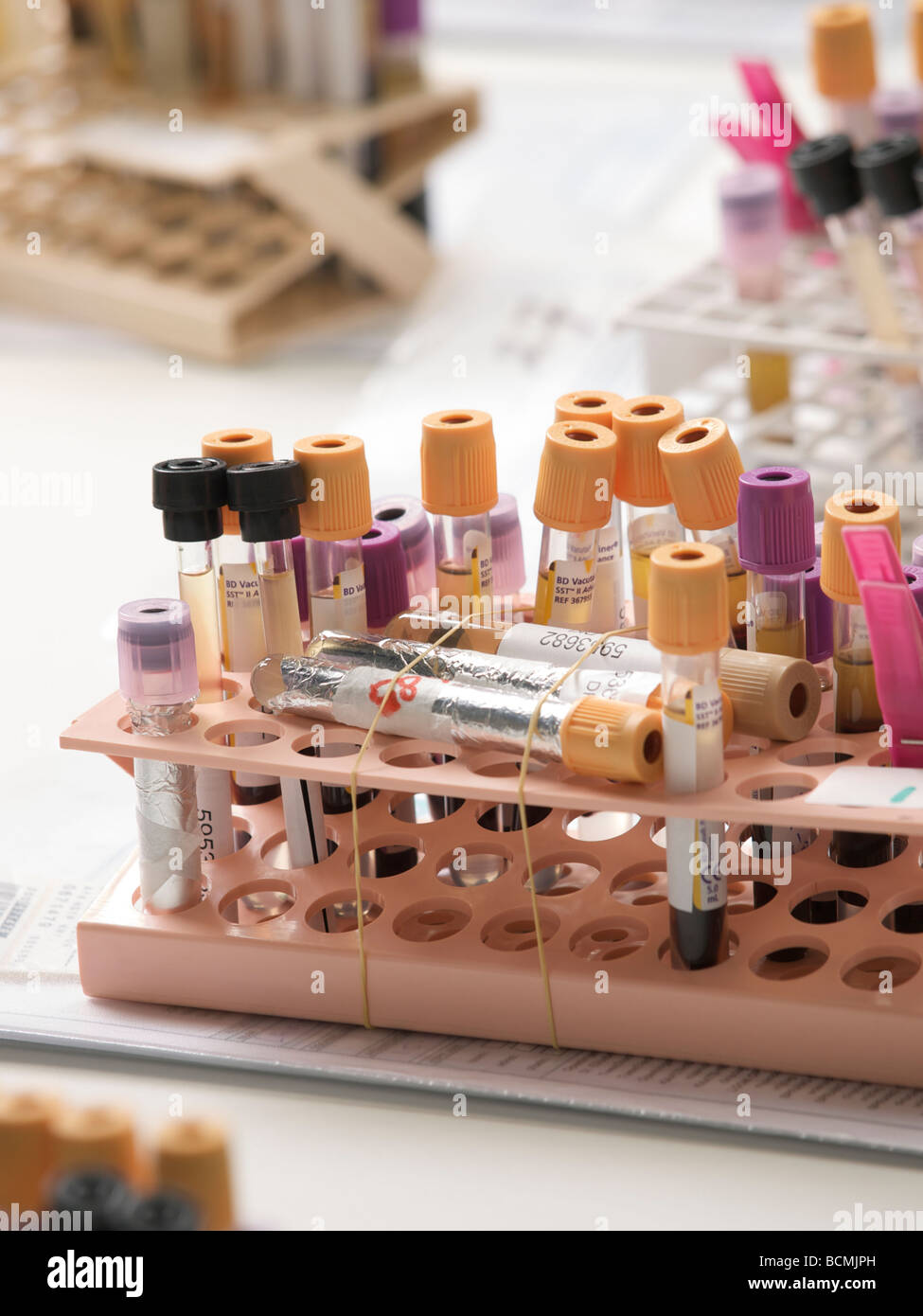 Rack of urine samples ready for examination in hospital laboratory