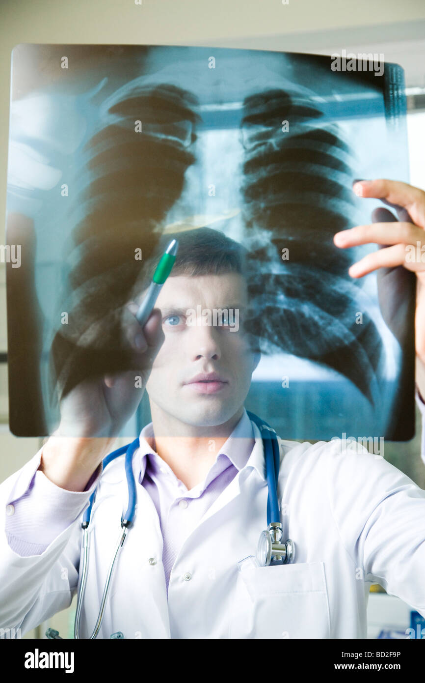 Lung x ray hi-res stock photography and images - Alamy