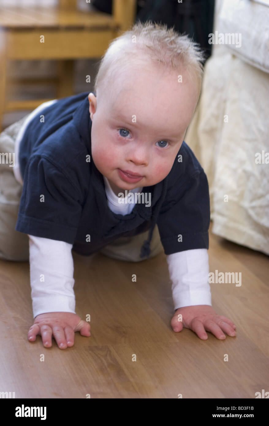 Baby boy disorder , down syndrome child crawling on the floor