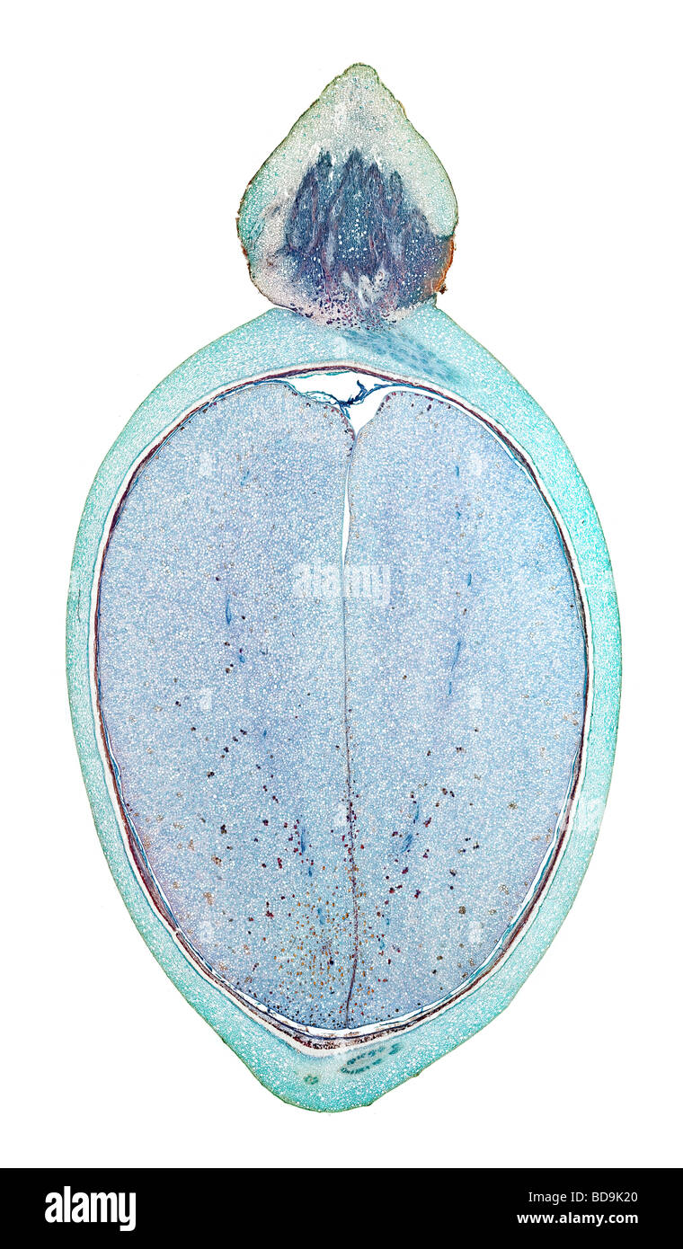 Brightfield photomicrograph stained section LS of Bay Laurel (Laurus nobilis) fruit berry Stock Photo