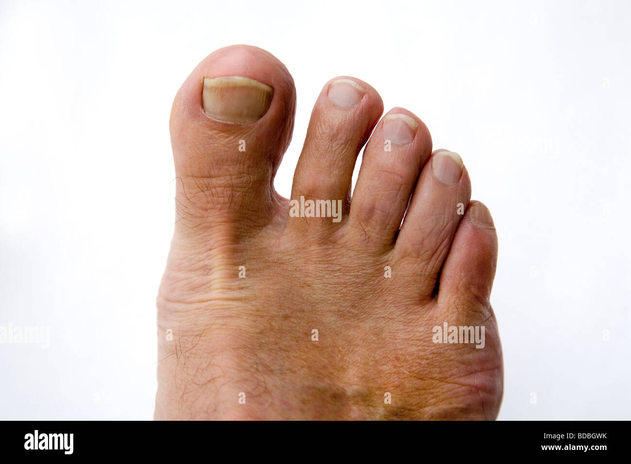 mens long hairy toes Ass great now