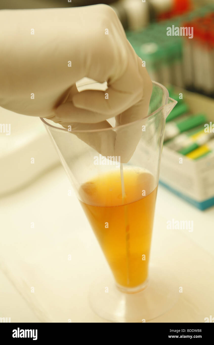 Urine pH testing Stock Photo Alamy