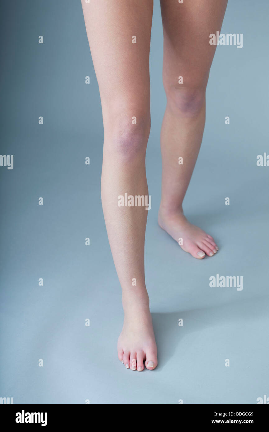 LEG Stock Photo - Alamy