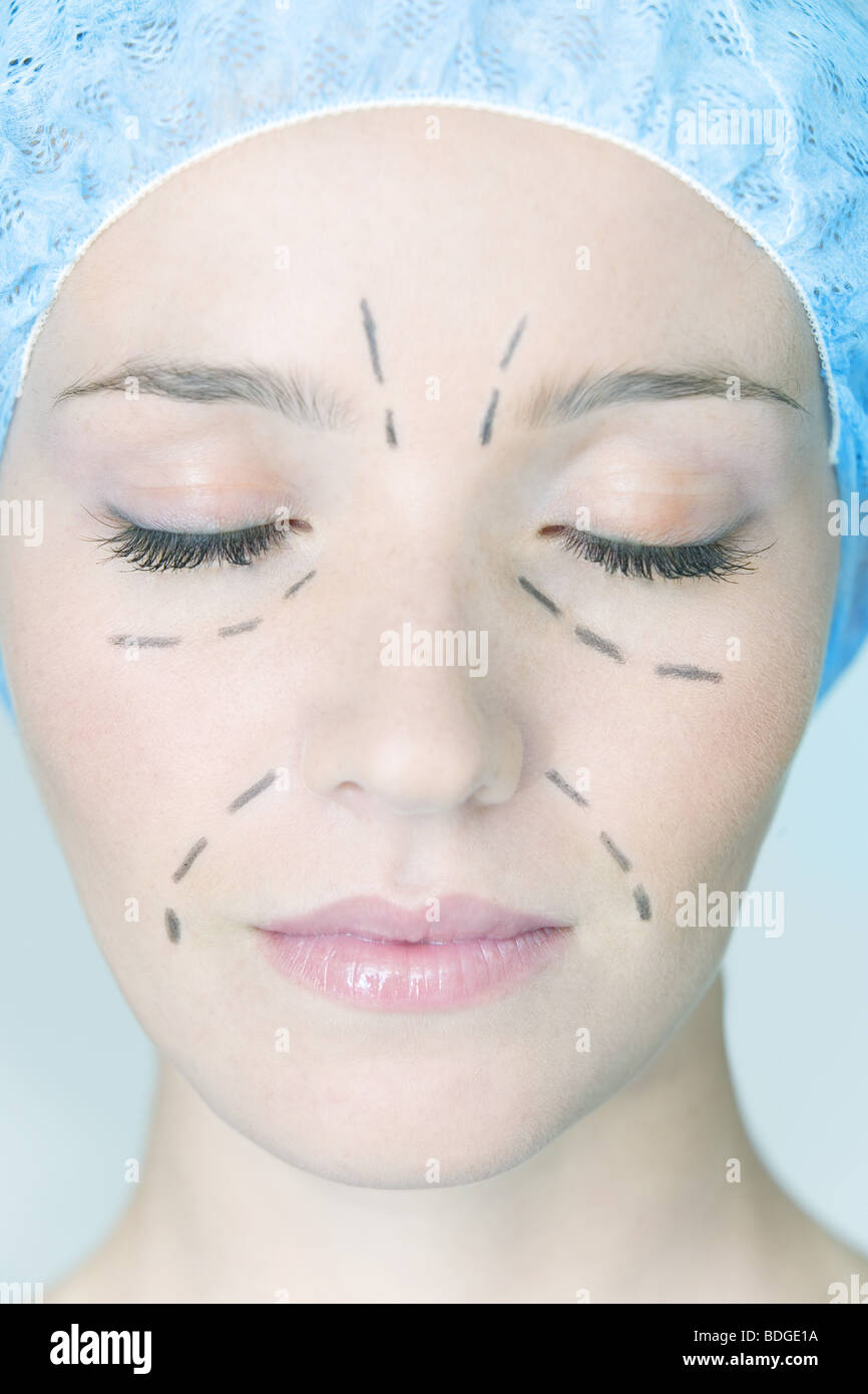 FACE PLASTIC SURGERY Stock Photo Alamy