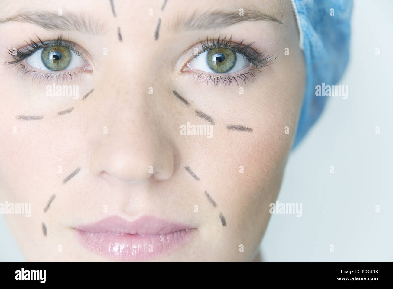 FACE PLASTIC SURGERY Stock Photo