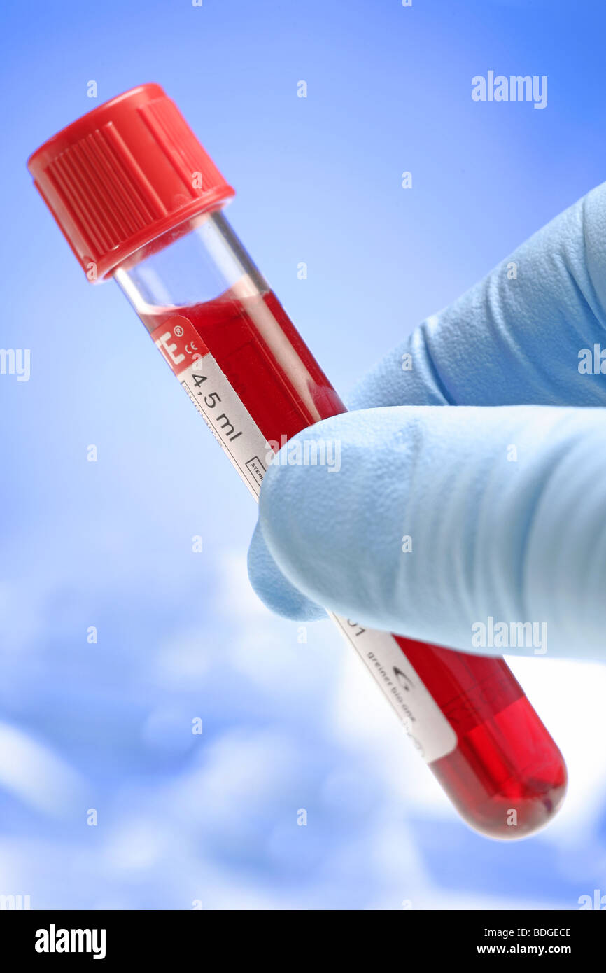 Hemodialysis catheters hires stock photography and images Alamy