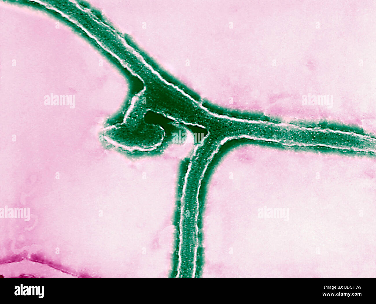 Marburg disease hi-res stock photography and images - Alamy