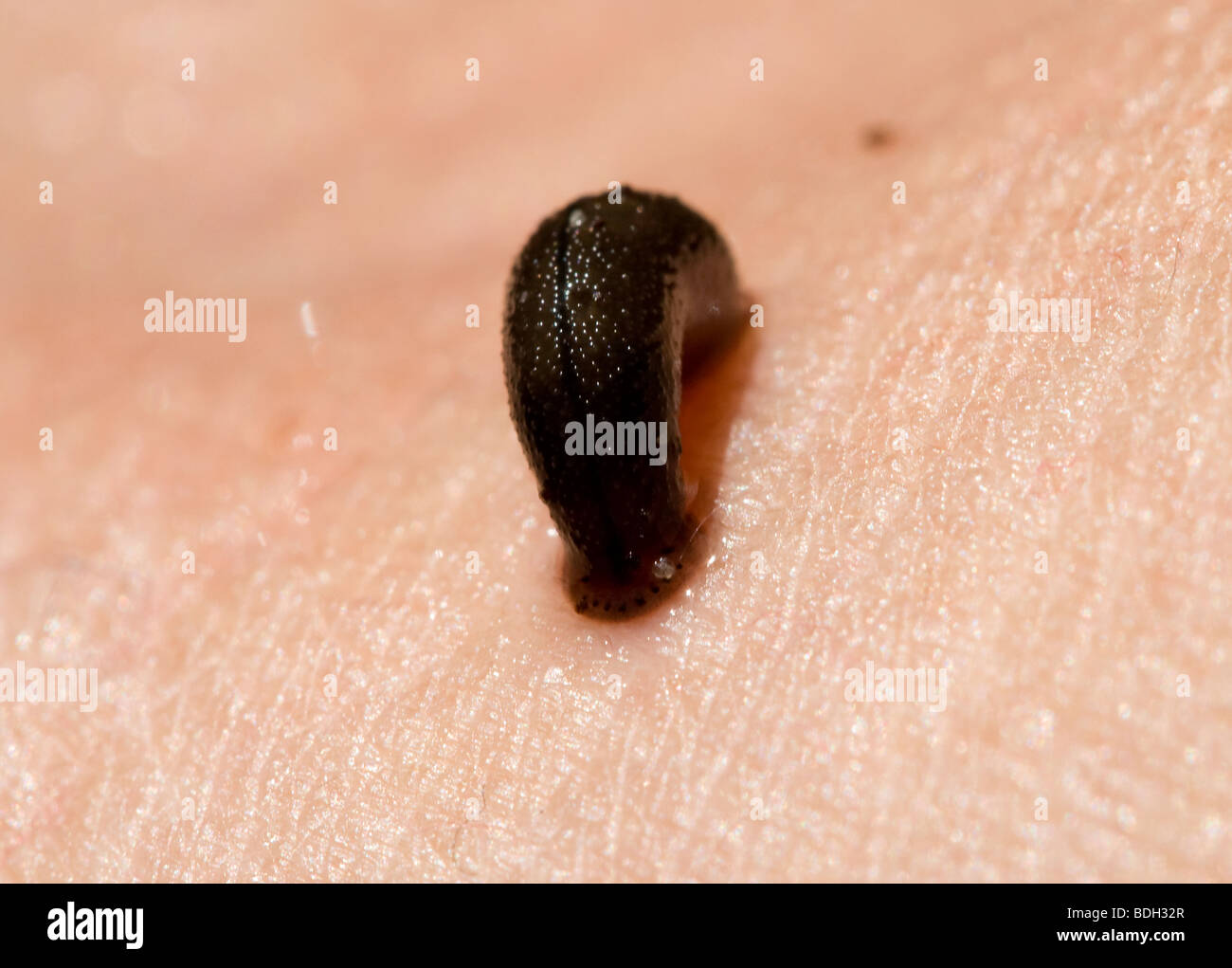 Leech bite hires stock photography and images Alamy