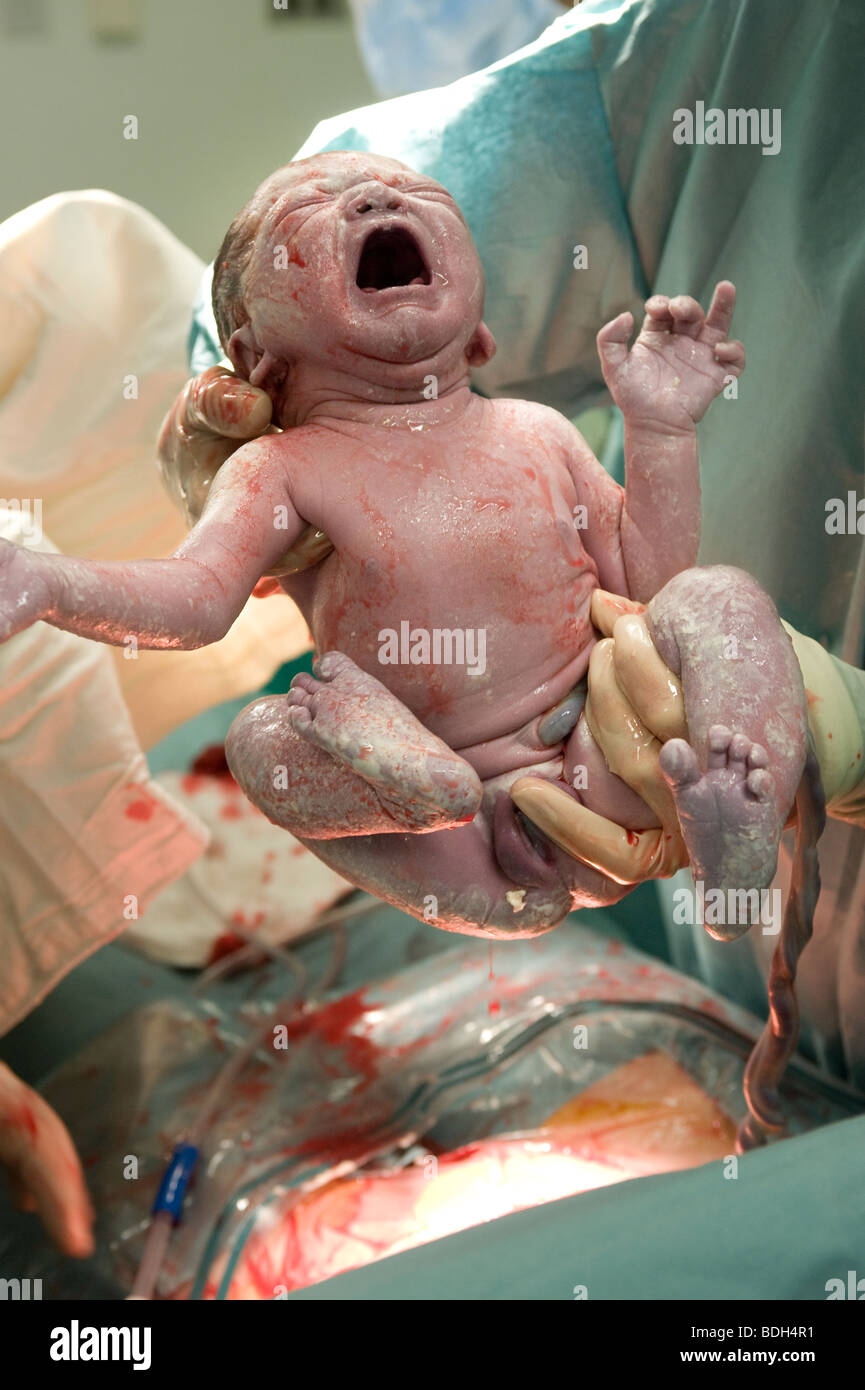 New born Caucasian baby girls first scream whilst being ...