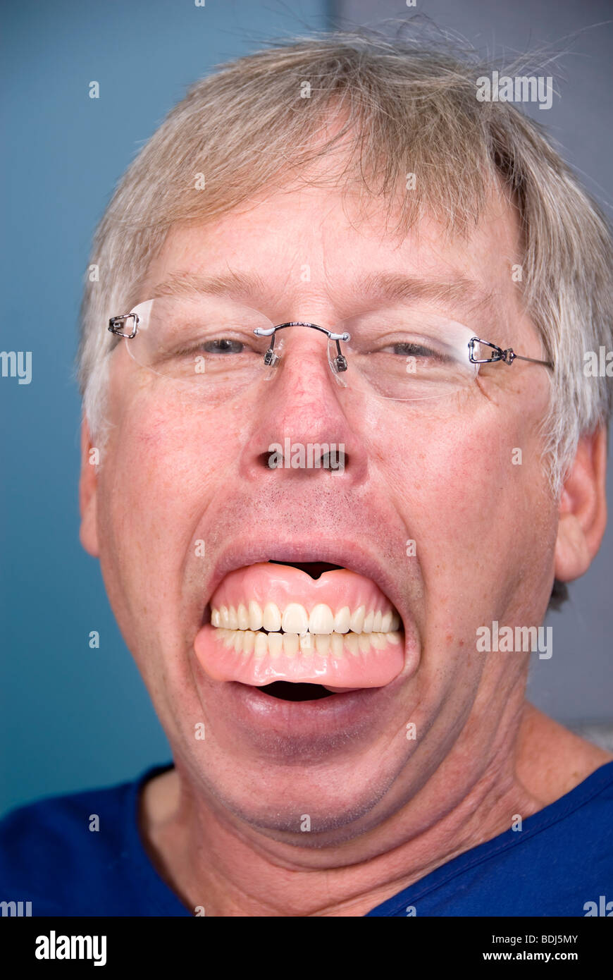 A man displays his false teeth (dentures) which shows what happens when you don't have good dental hygiene. Stock Photo