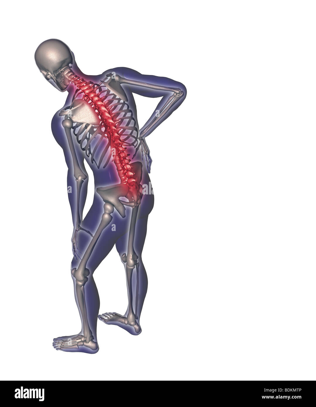 Illustration depicting back pain Stock Photo