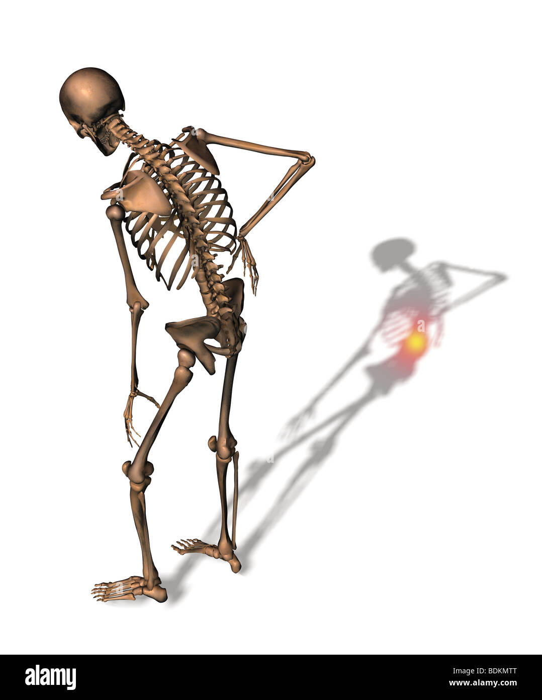 Illustration depicting back pain Stock Photo