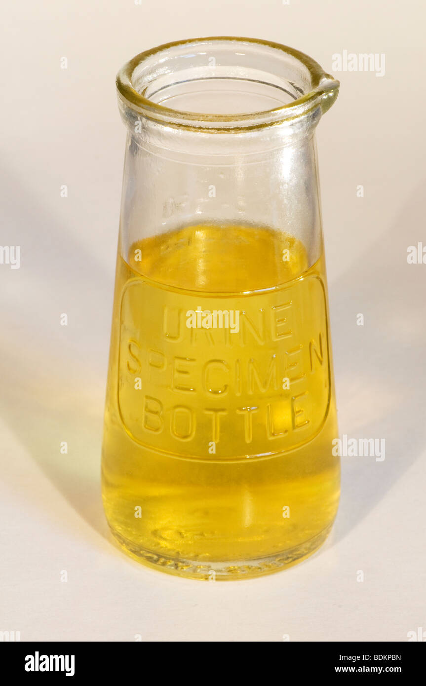 Urine sample in a urine specimen bottle Stock Photo Alamy