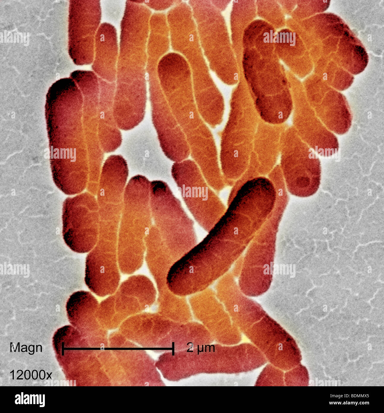 Scanning photomicrograph  of numbers of clustered Gram-negative Salmonella typhimurium bacteria at a magnification of 12000X Stock Photo