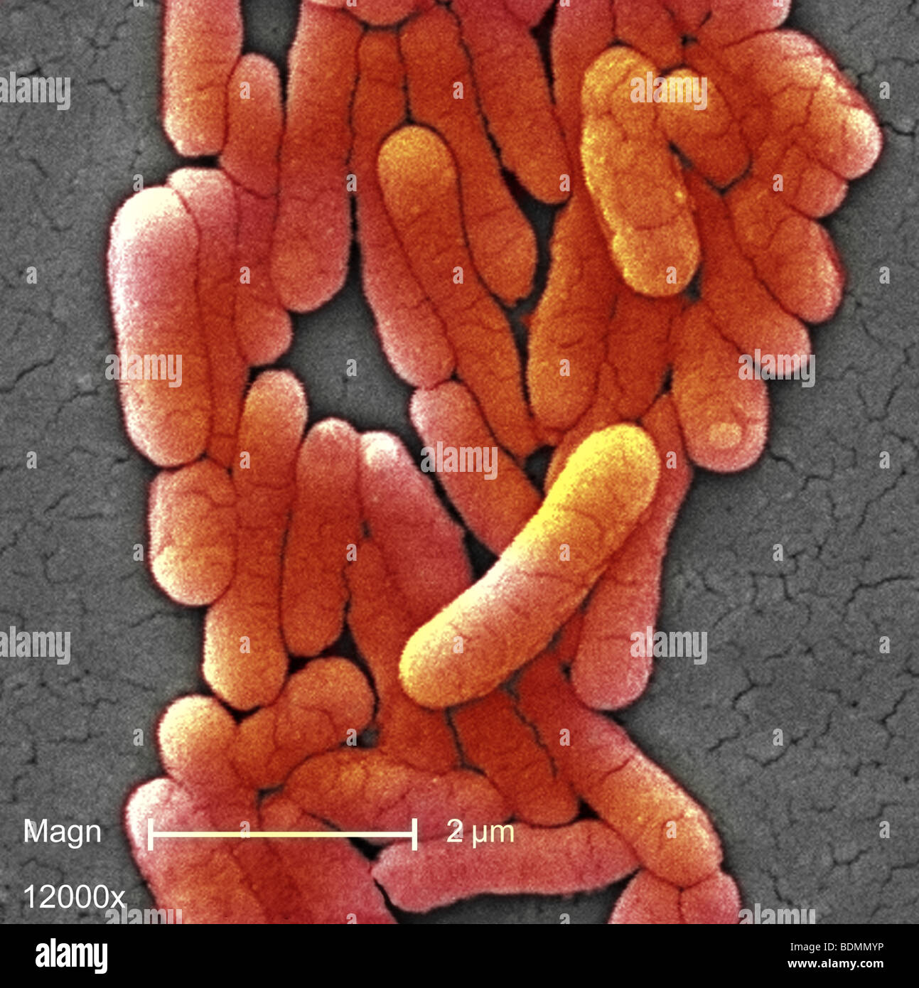 Scanning photomicrograph  of numbers of clustered Gram-negative Salmonella typhimurium bacteria at a magnification of 12000X Stock Photo