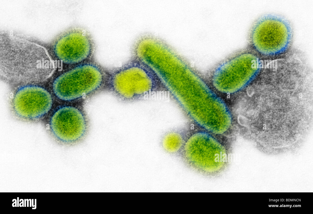 This negative stained transmission electron micrograph (TEM) showed recreated 1918 Spanish influenza A (H1N1) virions Stock Photo