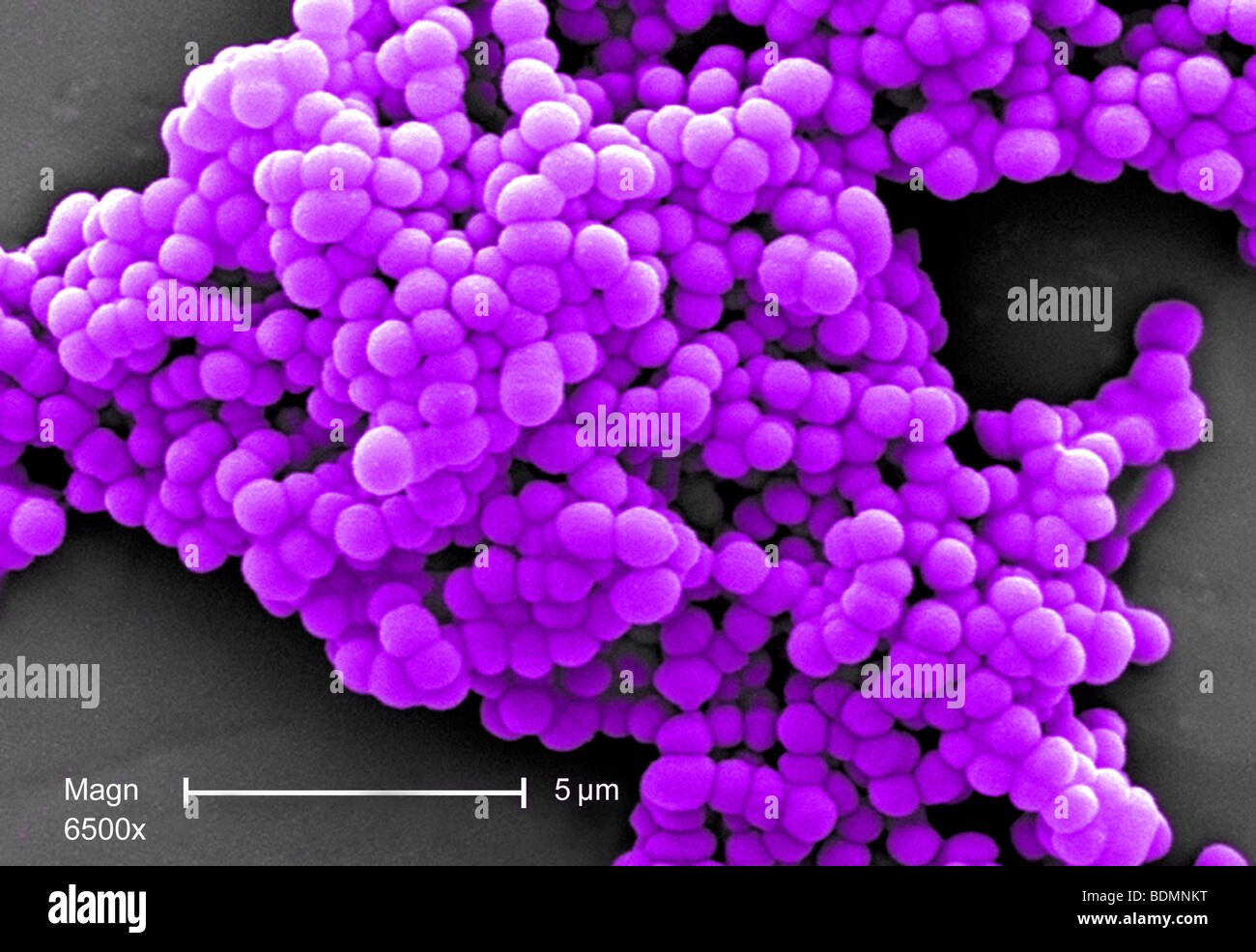 scanning electron micrograph (SEM) of clusters of Gram-positive, beta-hemolytic Group C Streptococcus sp. bacteria Stock Photo