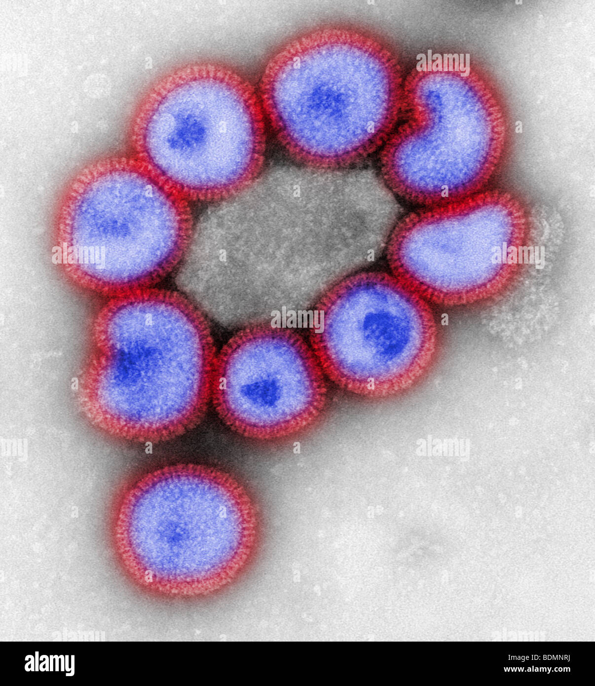 Negative-stained transmission electron micrograph (TEM) of a number of influenza virus particles Stock Photo