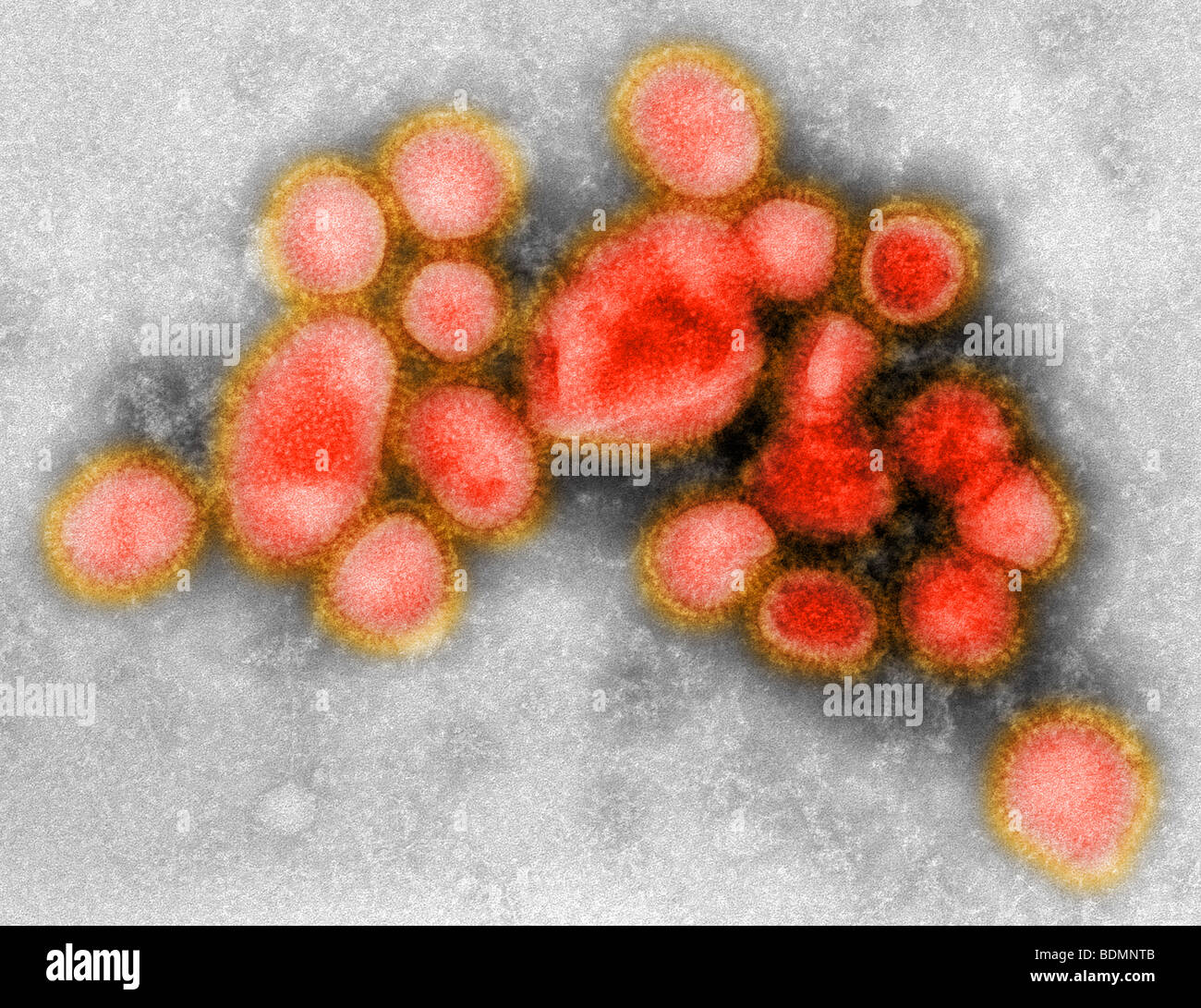 Images of the newly identified H1N1 influenza virus Stock Photo