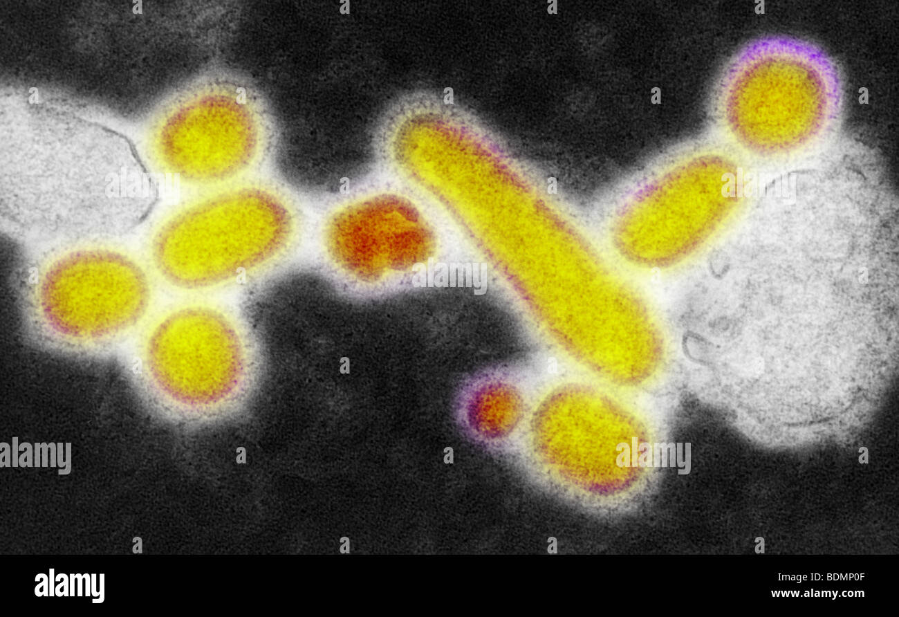 Negative stained transmission electron micrograph (TEM)  of recreated 1918 Spanish influenza A (H1N1) virions Stock Photo