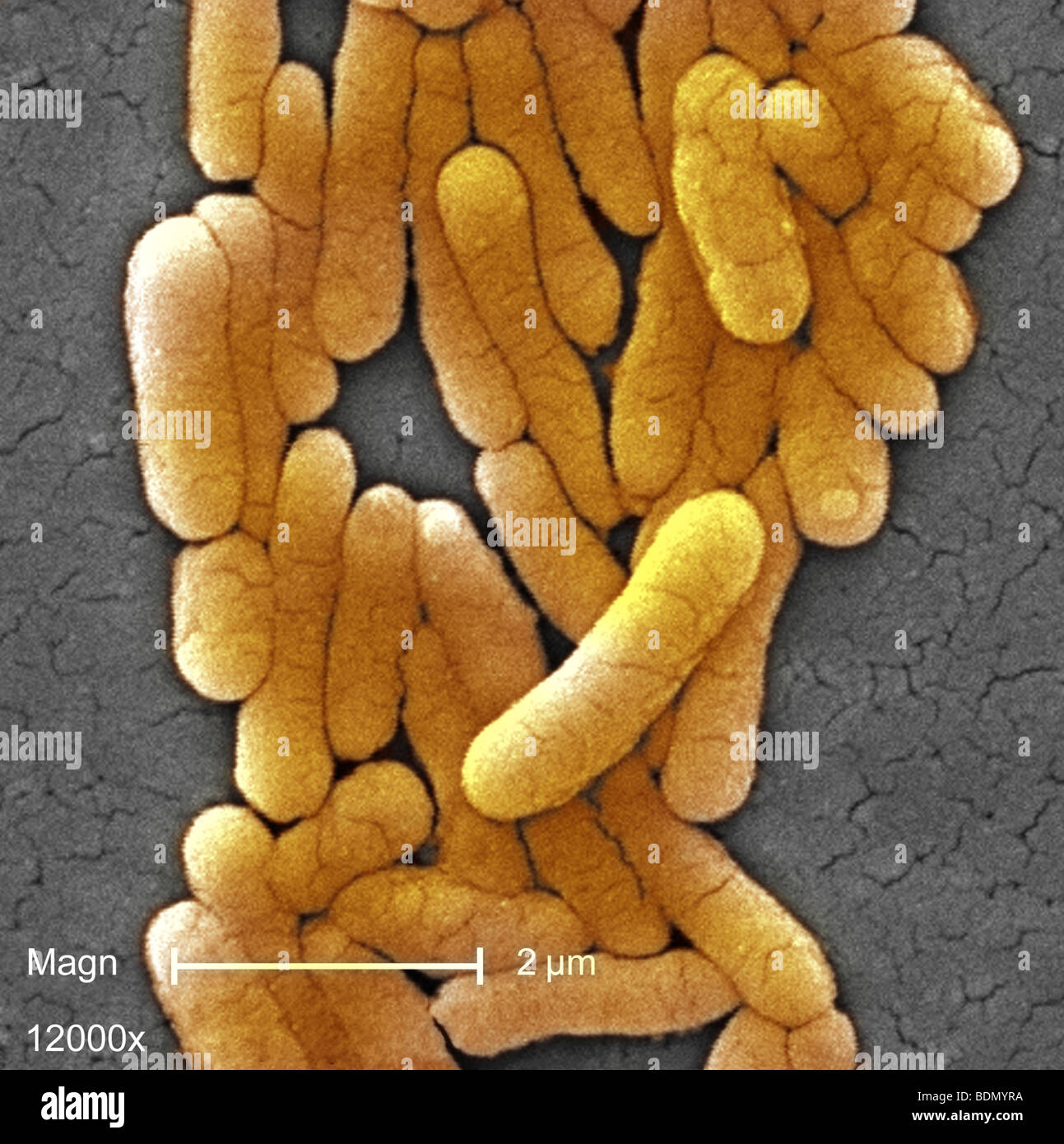 Scanning photomicrograph of numbers of clustered Gramnegative