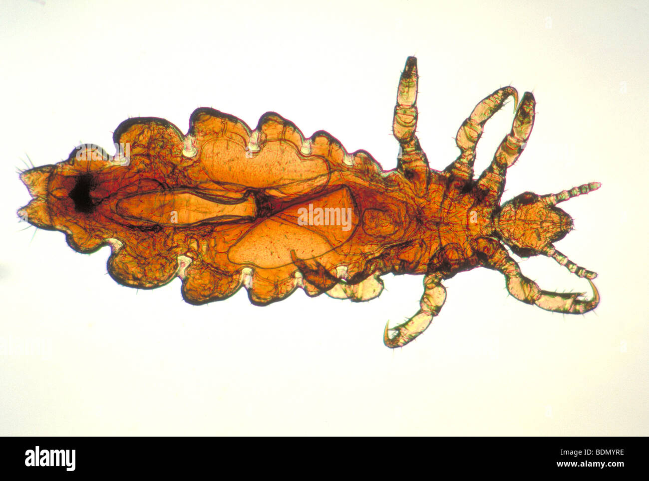 Photomicrograph of a female head louse, Pediculus humanus var. capitis Stock Photo