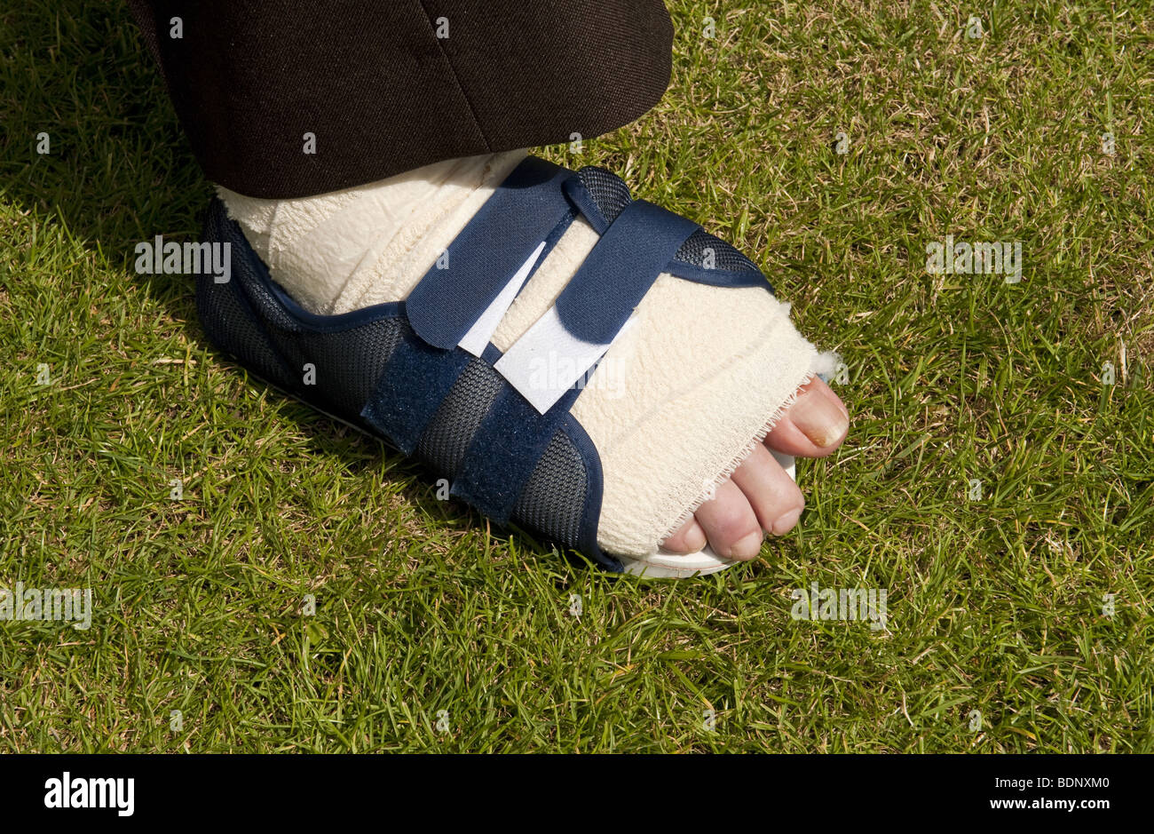 Suited man's foot bandaged up in velco on shoe after bunion surgery operation Stock Photo