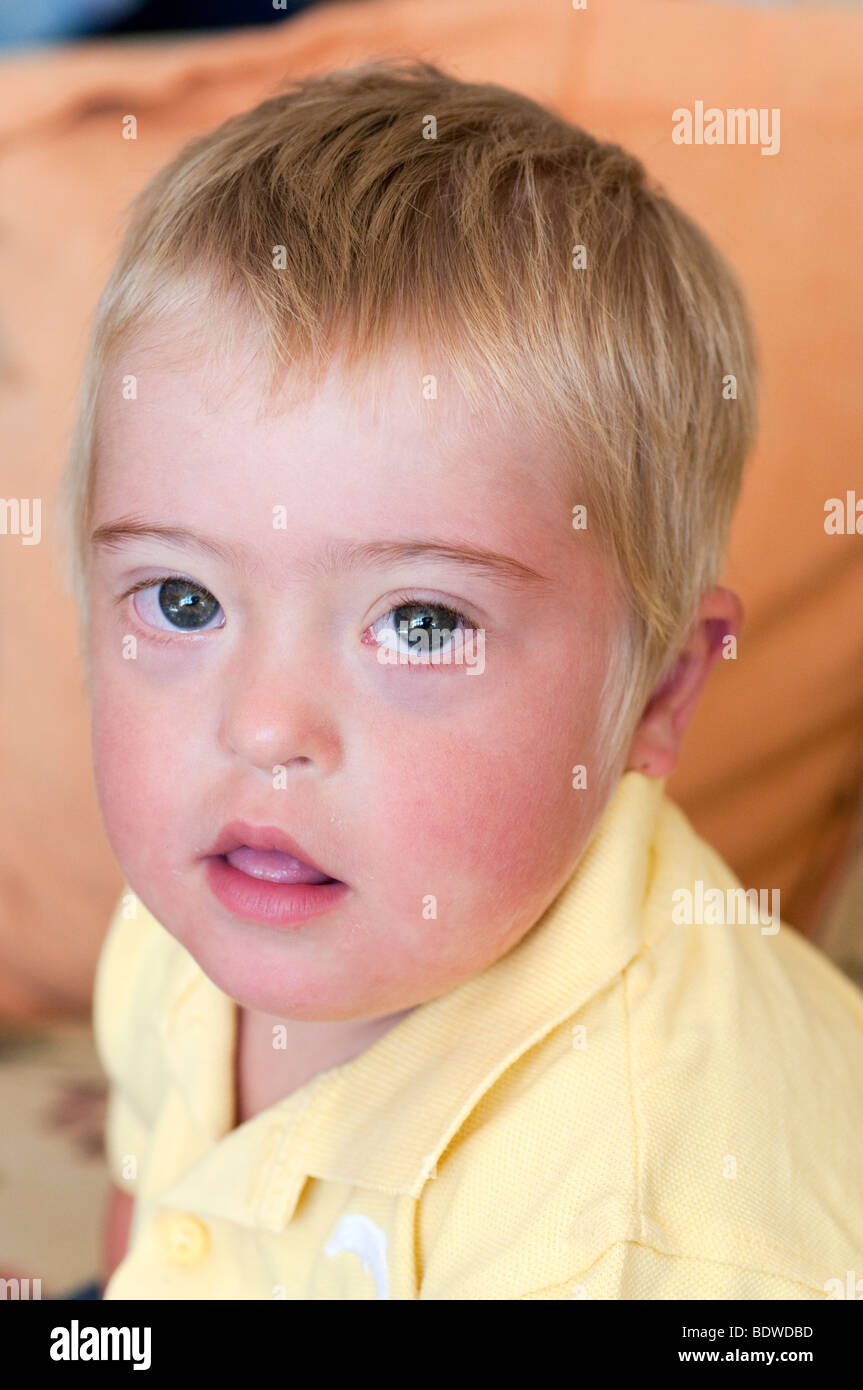 Iago is a boy of 2 years with Down's syndrome Stock Photo