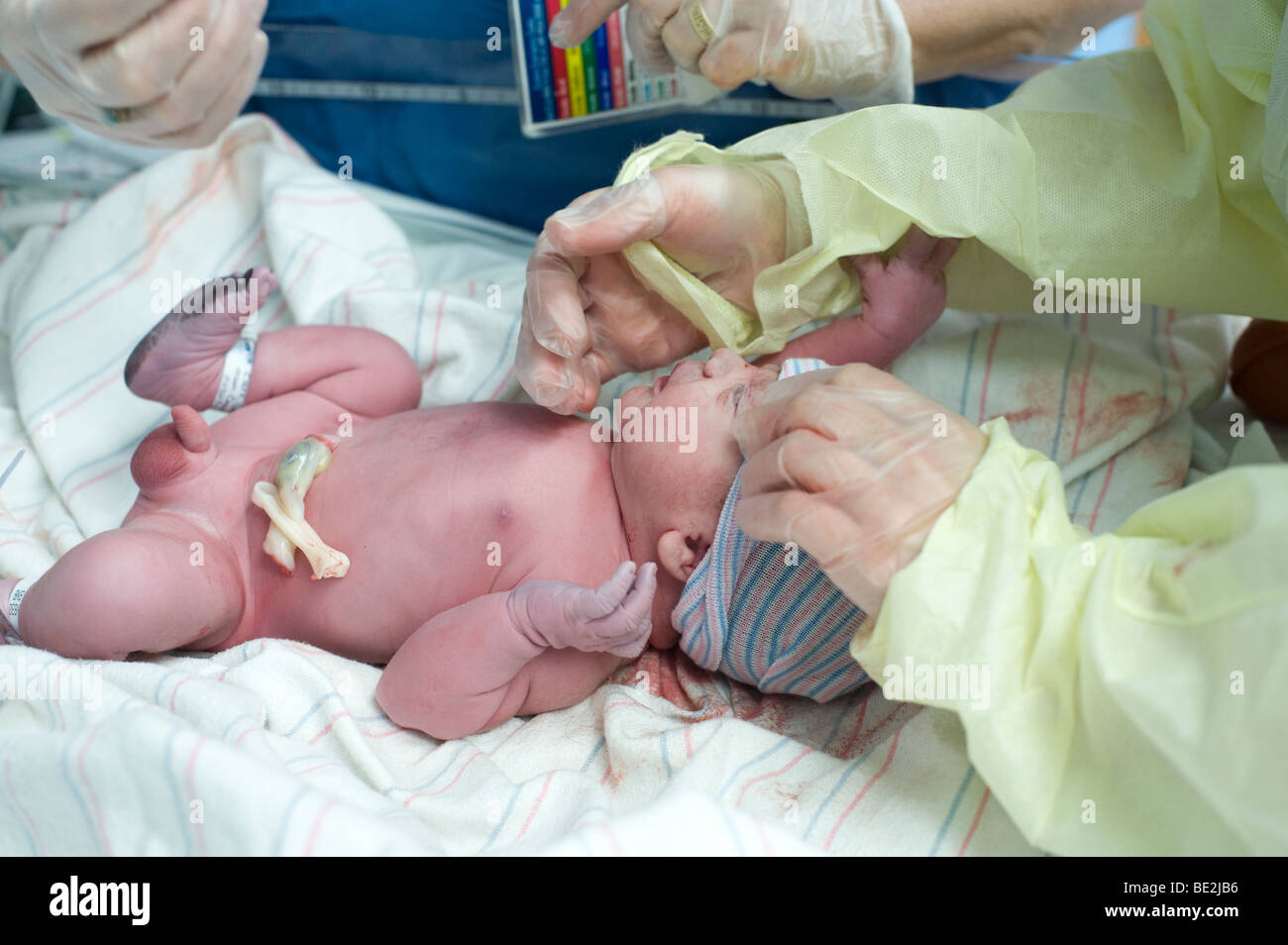 Baby eye drops hires stock photography and images Alamy