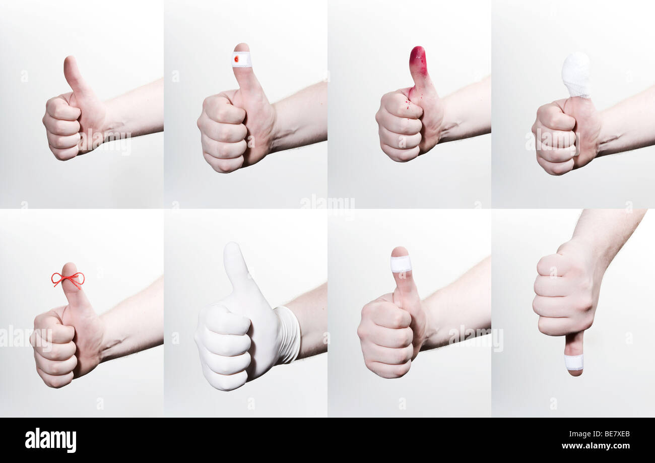 Thumbs up in various positions, red string to remember, patch, spray paint, latex gloves, injured, bandaged, thumbs down Stock Photo