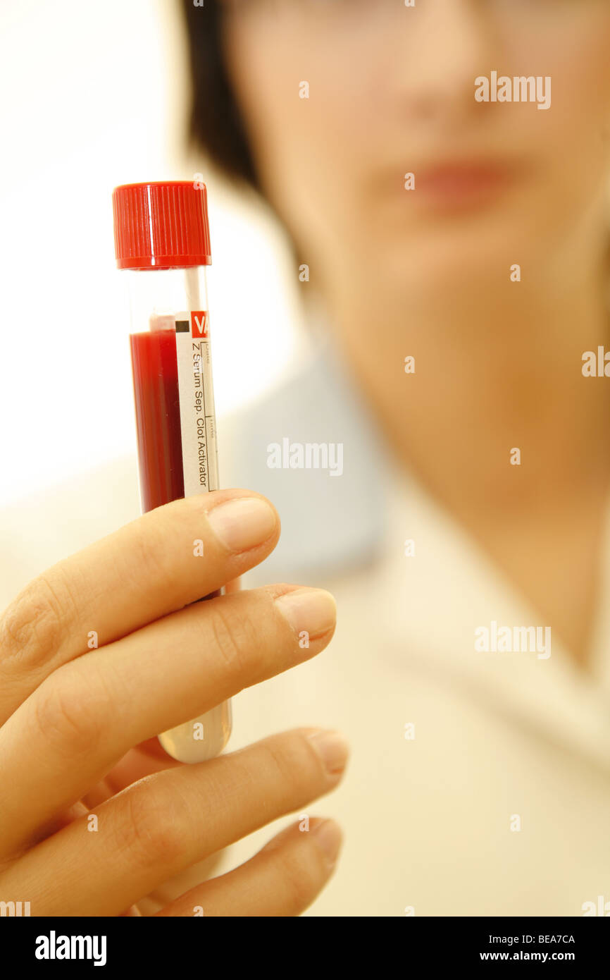 Nurse holding test tube with blood. Stock Photo