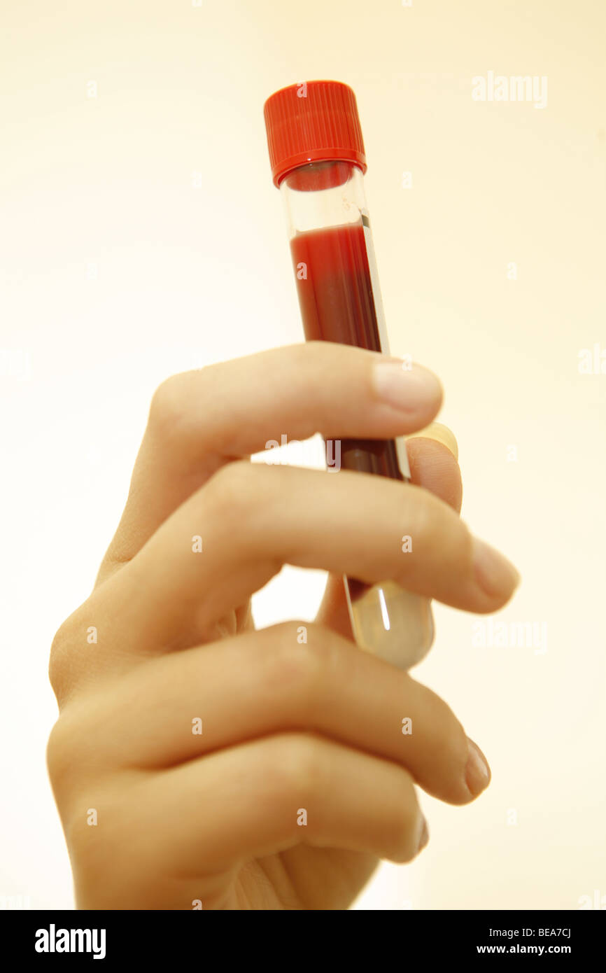 Nurse holding test tube with blood. Stock Photo