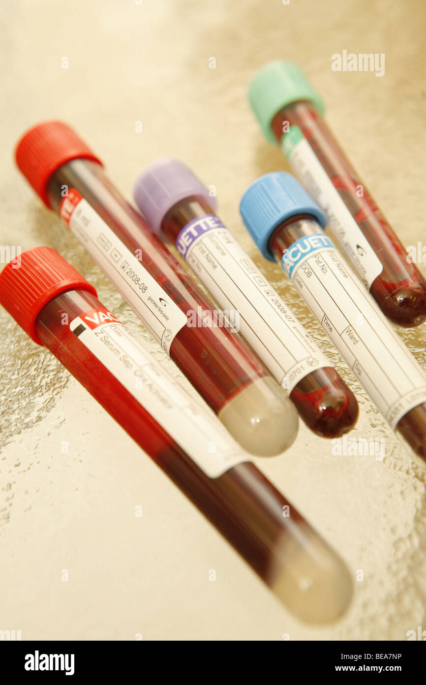 Test tubes with blood. Stock Photo