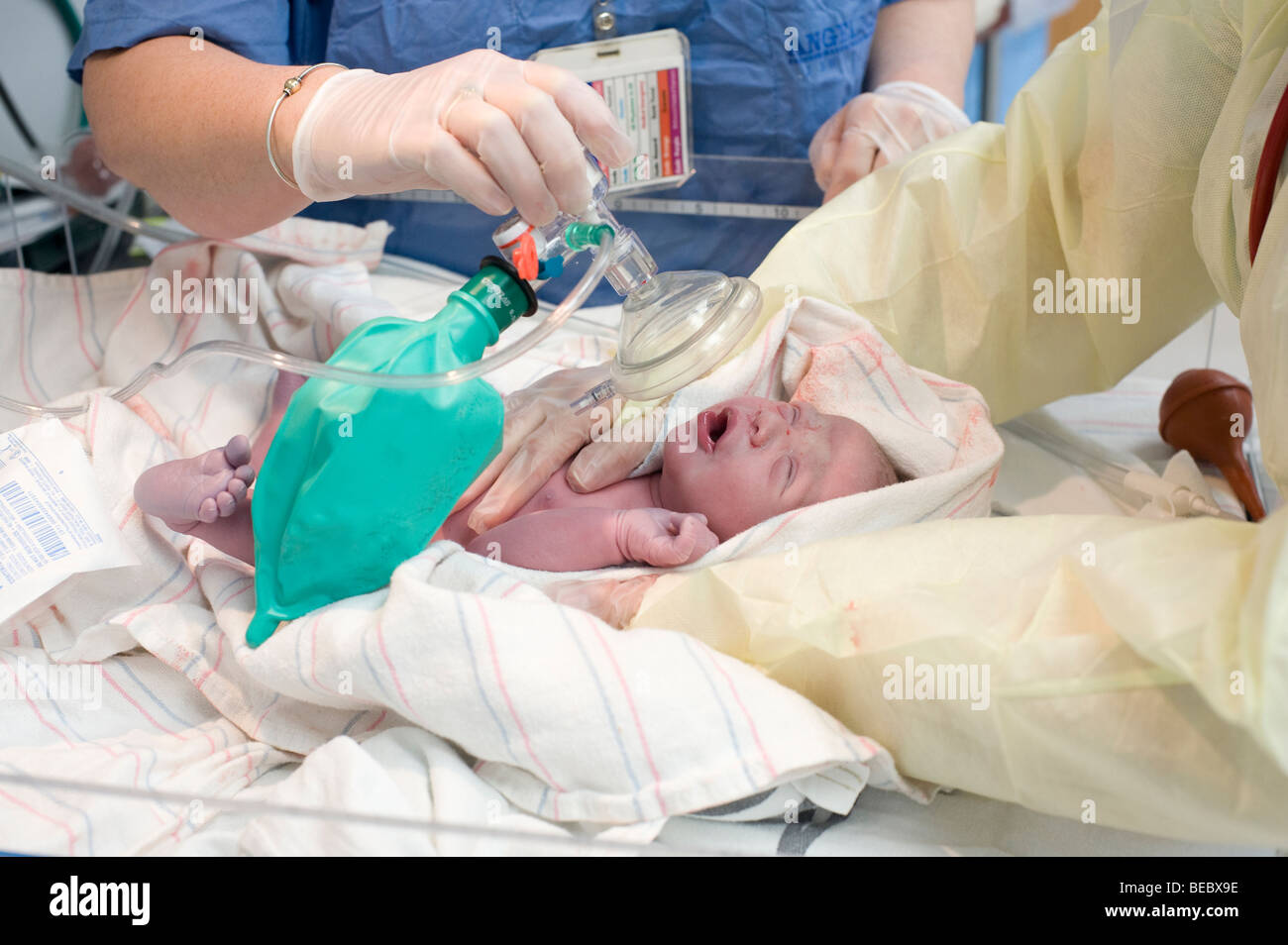 Screaming newborn Hispanic baby boy receives oxygen immediately after his arrival via CSection