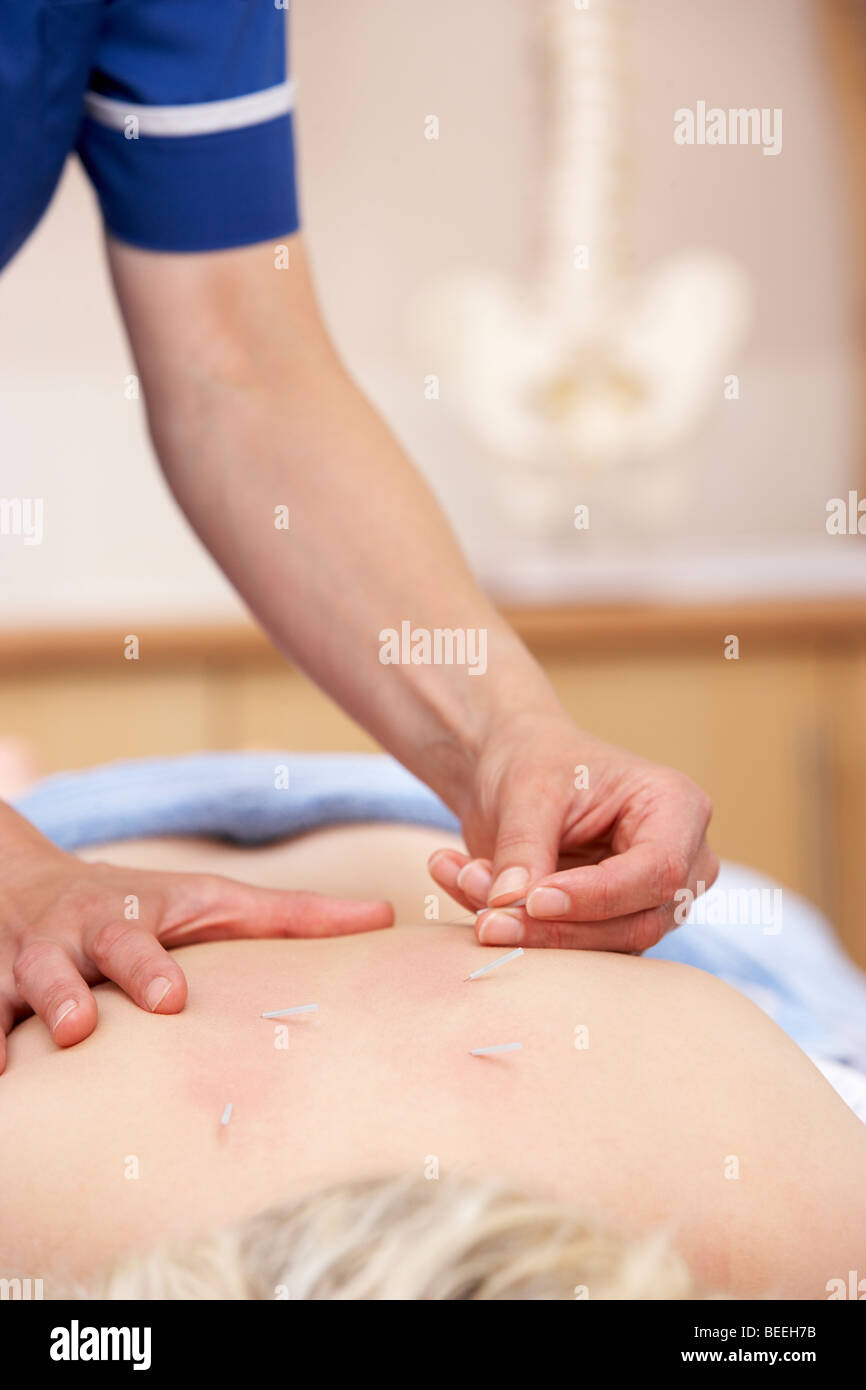 Acupuncturist treating female client Stock Photo
