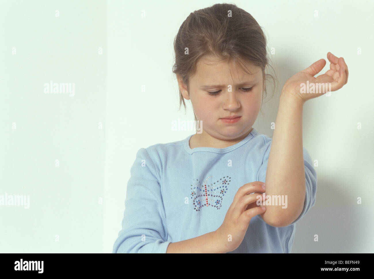 girl with eczema scratching Stock Photo Alamy