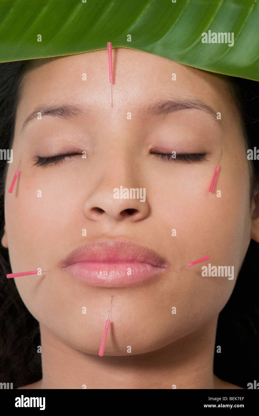 Woman with acupuncture needles on her face Stock Photo Alamy