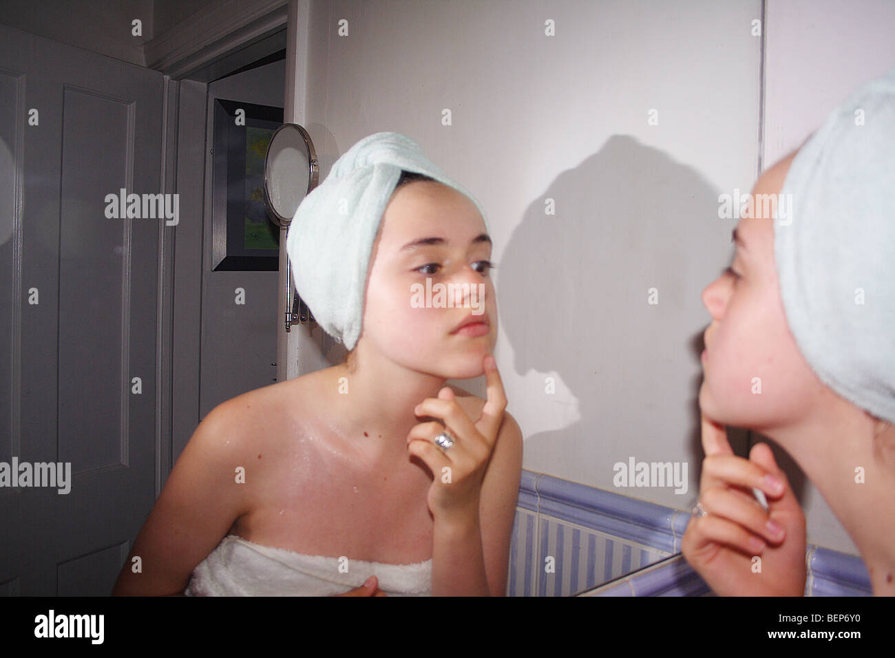 teenage acne blackheads spots Stock Photo