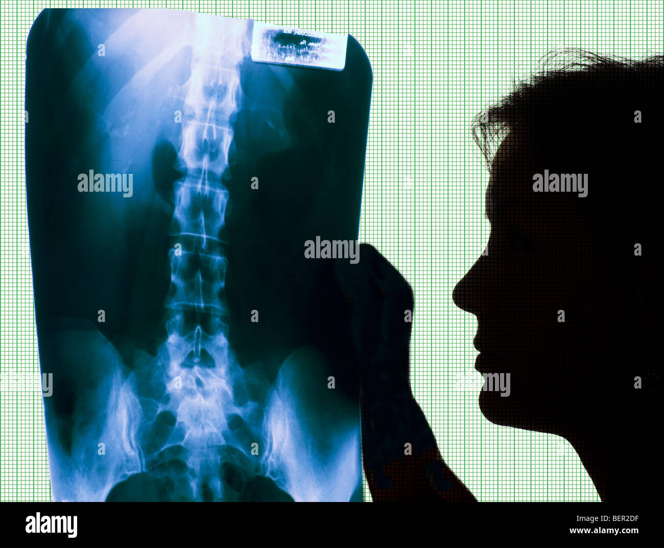Spine x ray hi-res stock photography and images - Alamy