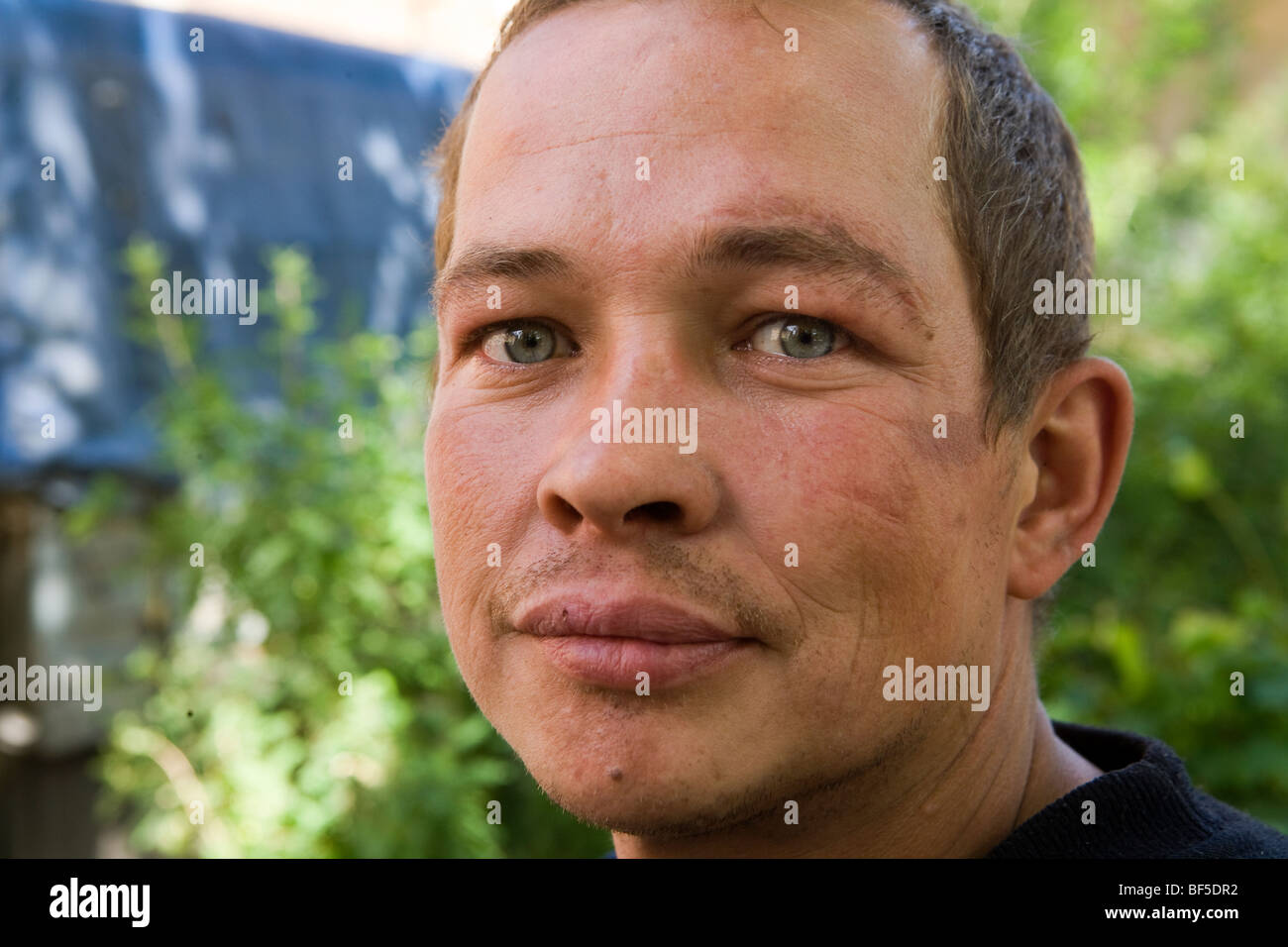 Scar on face hires stock photography and images Alamy