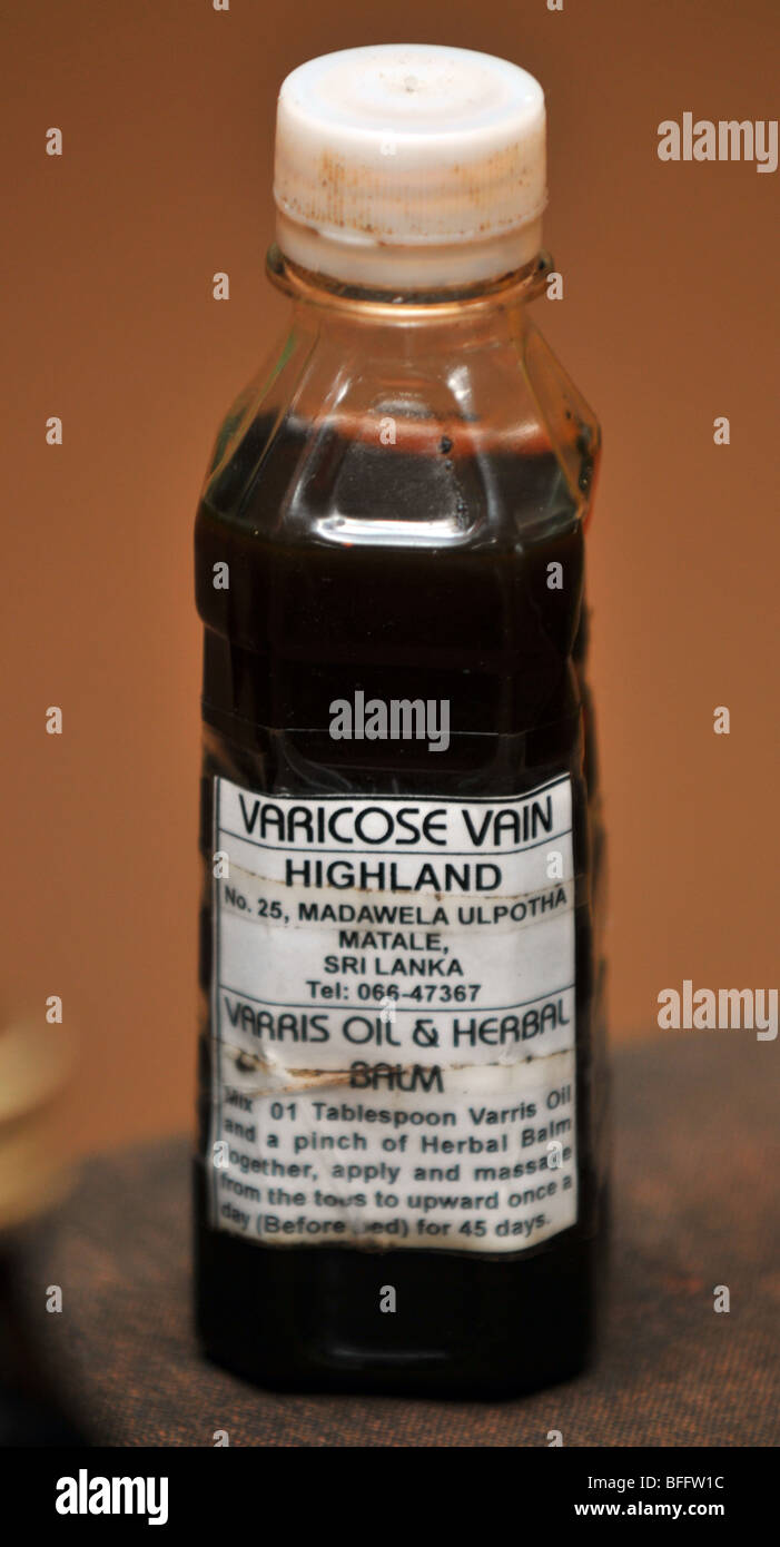 Herbal varicose vain treatment Stock Photo