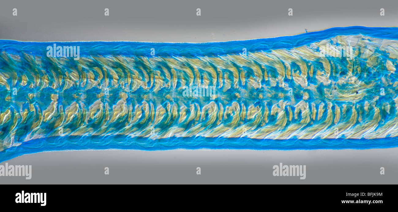Photomicrograph of radula of periwinkle showing teeth like ridges Stock Photo
