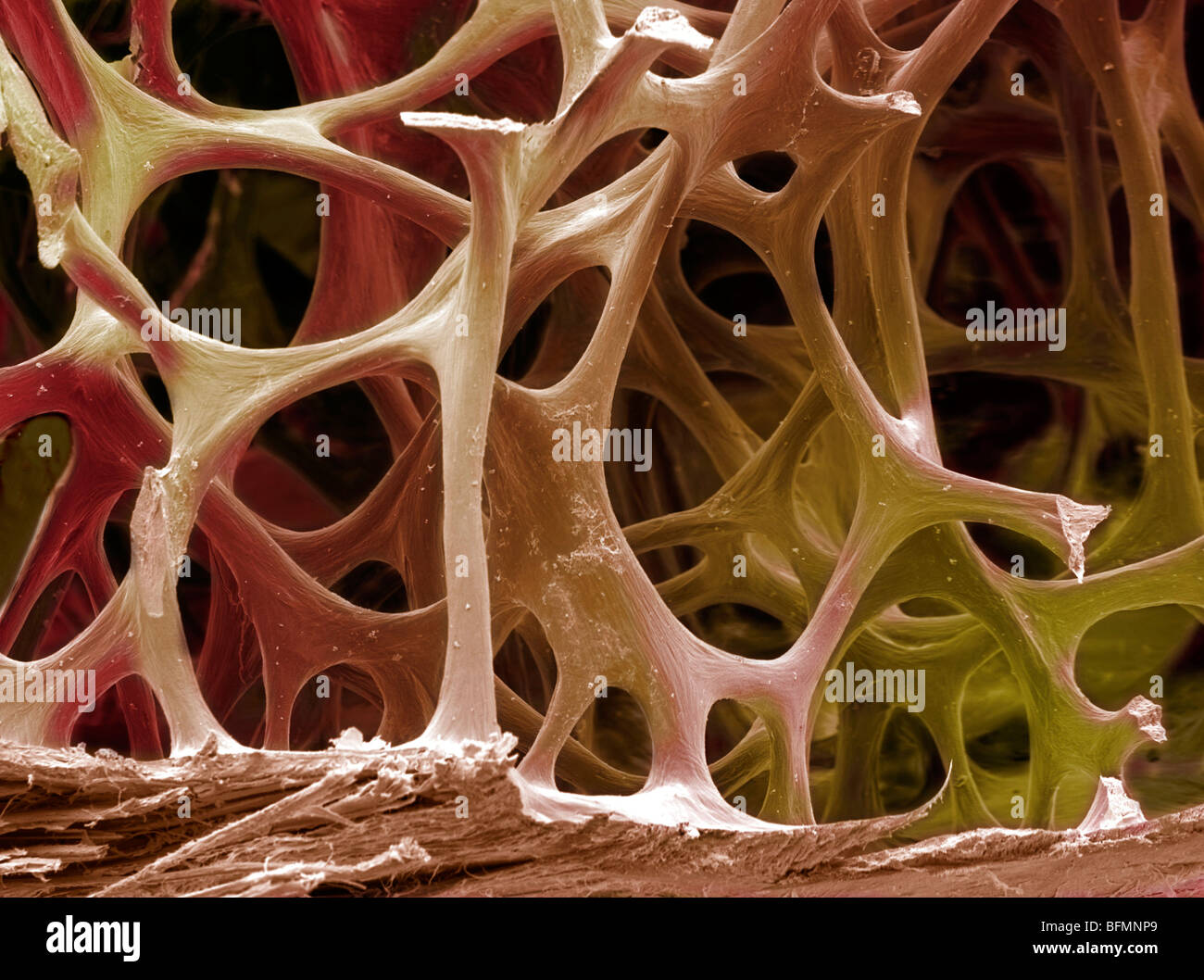 bone tissue sem stock photo 26886337 alamy bone tissue